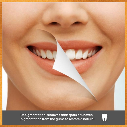 Perla dental Depigmentation per arch 