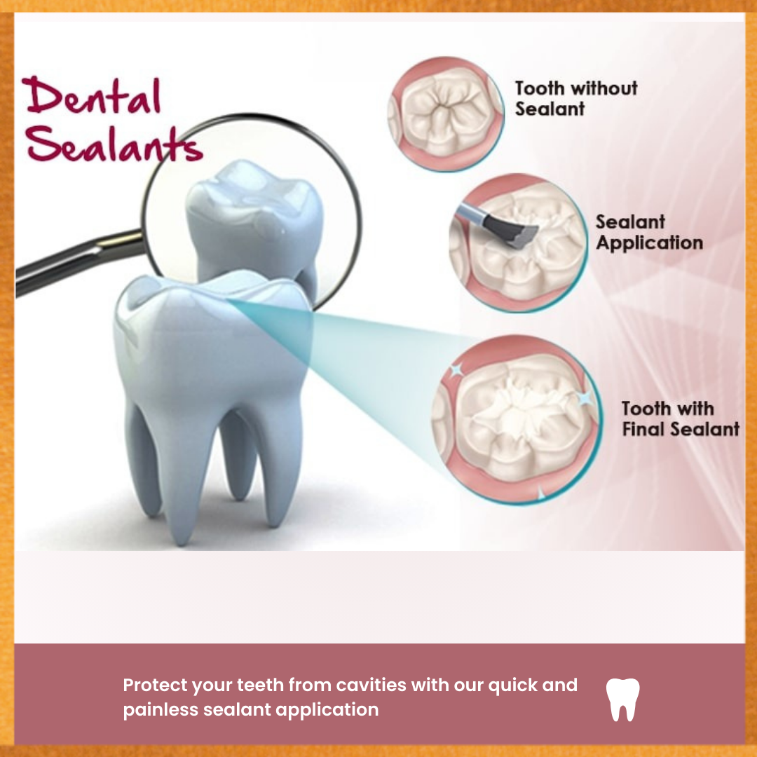 Protective Sealant – Shield Your Teeth from Cavities – Perla Dental