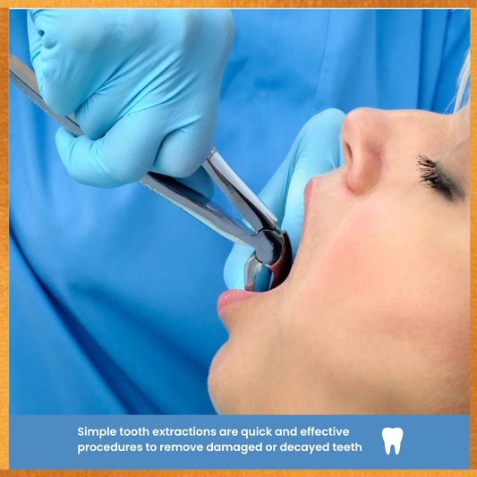 Perla dental Simple extractions 