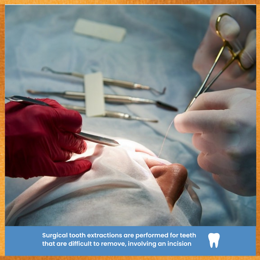 Perla dental Surgical extraction (with sutures)