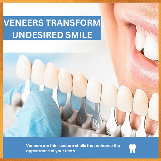 Perla dental veneer